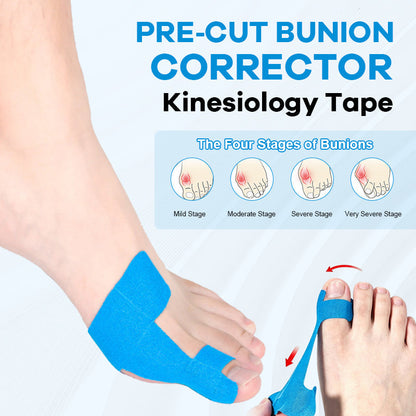 👣 Előre kivágott hallux valgus korrekciós kineziológiai tapasz – fájdalom nélküli lépések, természetes tartás