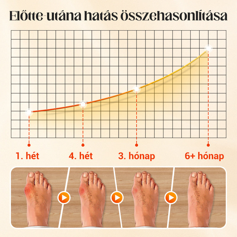🔥 Forró akció! Uniszex láthatatlan korrekciós ötujjú zokni – Egészséges lábfej, kényelmes lépések! 🧦✨
