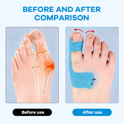 👣 Előre kivágott hallux valgus korrekciós kineziológiai tapasz – fájdalom nélküli lépések, természetes tartás