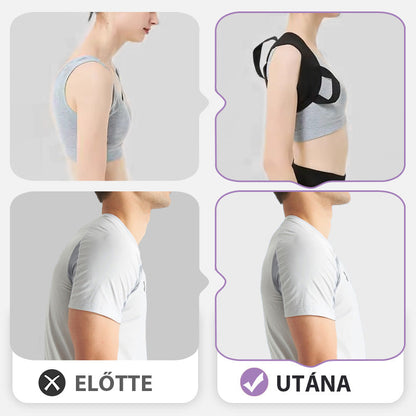 🚨 Időkorlátozott „egy plusz egy ingyen” akció! 🔥 Unisex háttartás-korrekciós öv [XS-2XL] 💆‍♀️——Viseld minden nap, és a természetes, egyenes testtartás magától jön!