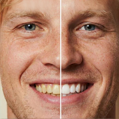 ✨ Azonnali fogfehérítő fogkrém — Az eredmények azonnal láthatóak! 5 ml-es kiszerelés, hosszú élettartam! 😁🦷