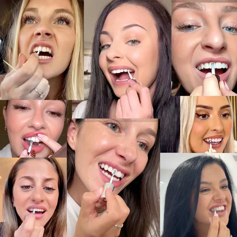 ✨ Azonnali fogfehérítő fogkrém — Az eredmények azonnal láthatóak! 5 ml-es kiszerelés, hosszú élettartam! 😁🦷